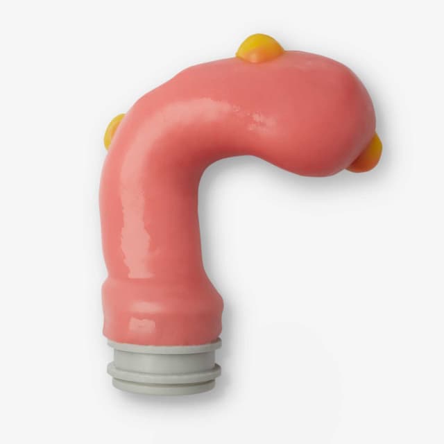 Myomectomy Class II