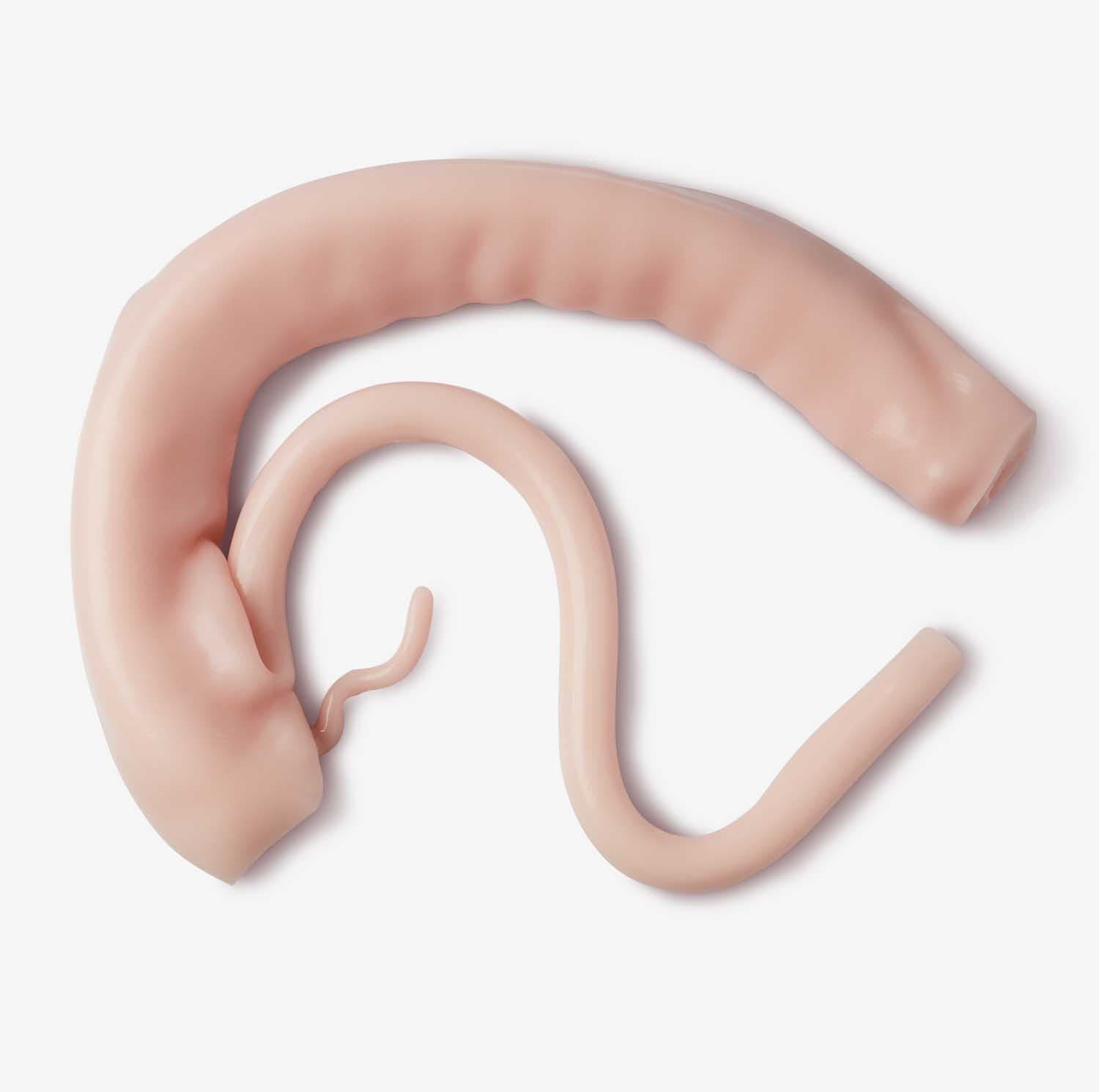 Colorectal