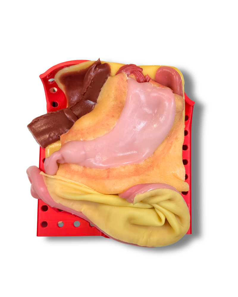 Bariatric