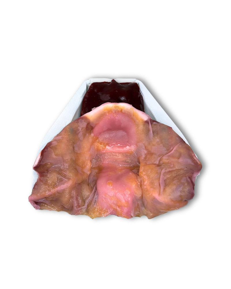 Urology