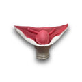 UV Anastomosis (Class III)