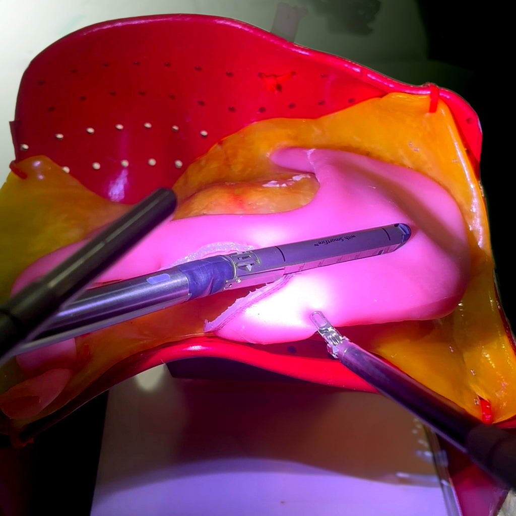Gastric Model (Class II)