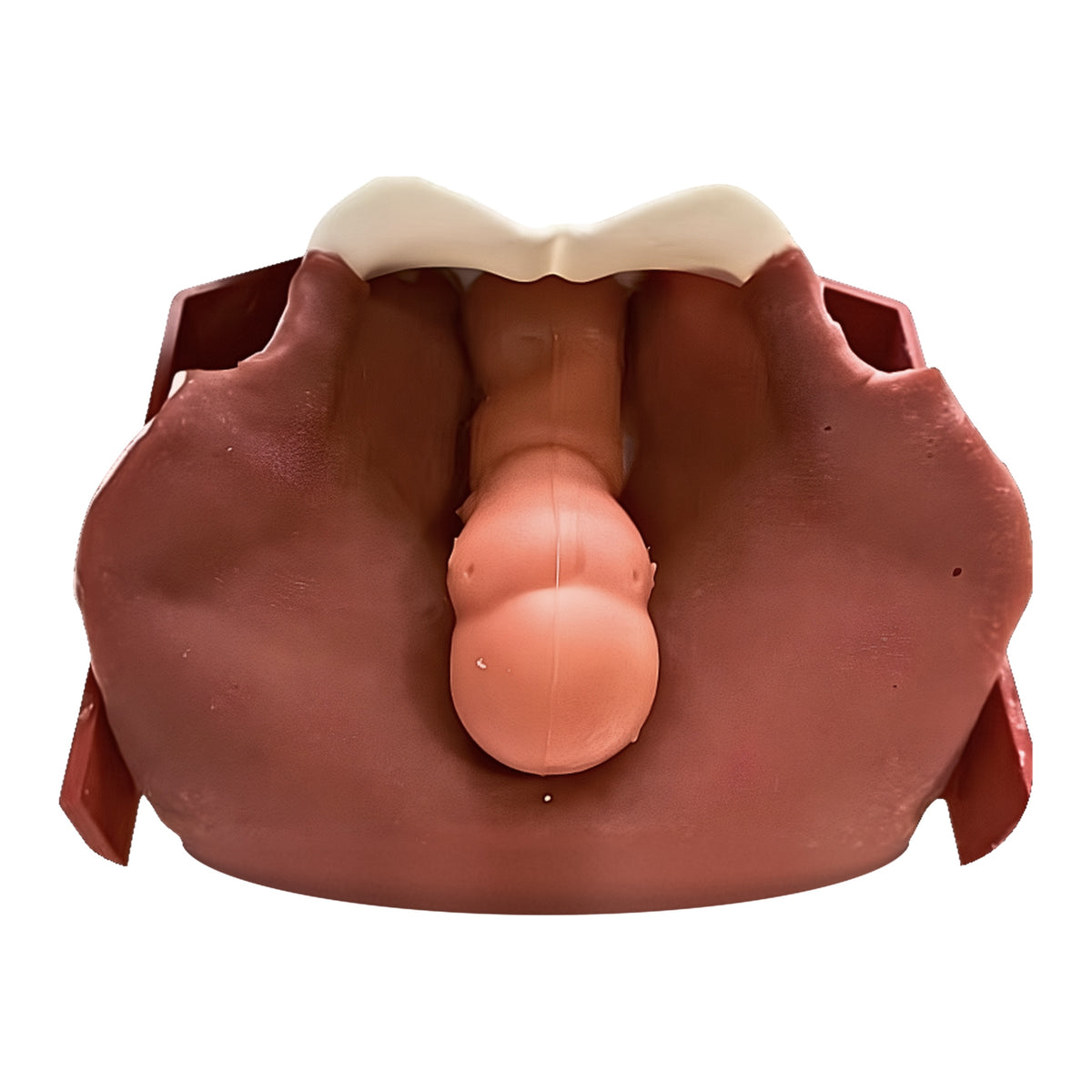 Gynaecology (Class III)