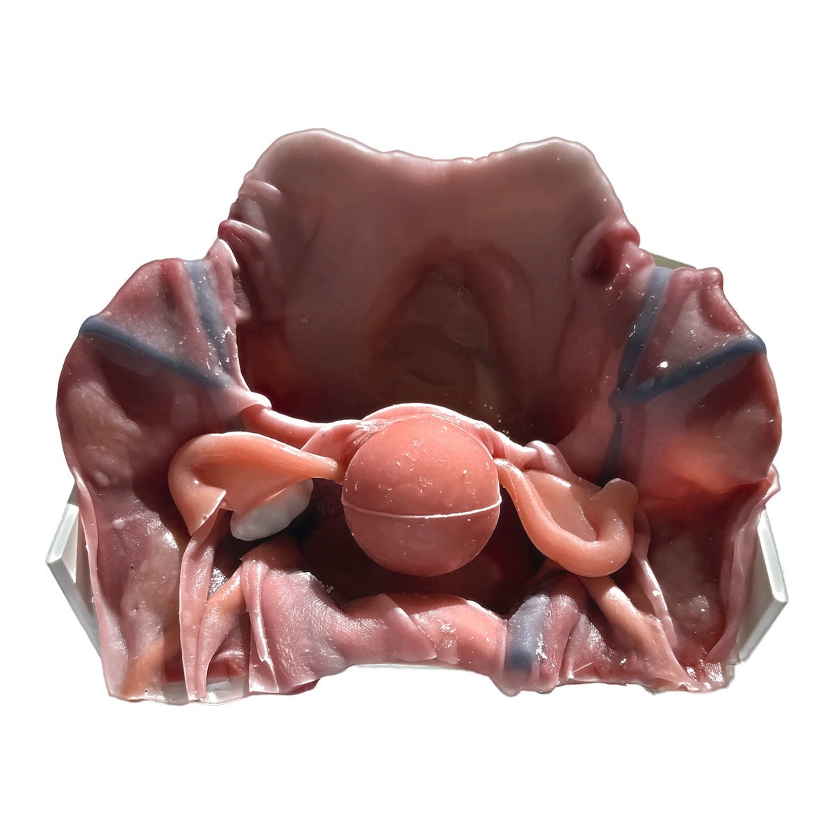 Gynaecology (Class IV)