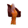 Cholecystectomy (Class III)