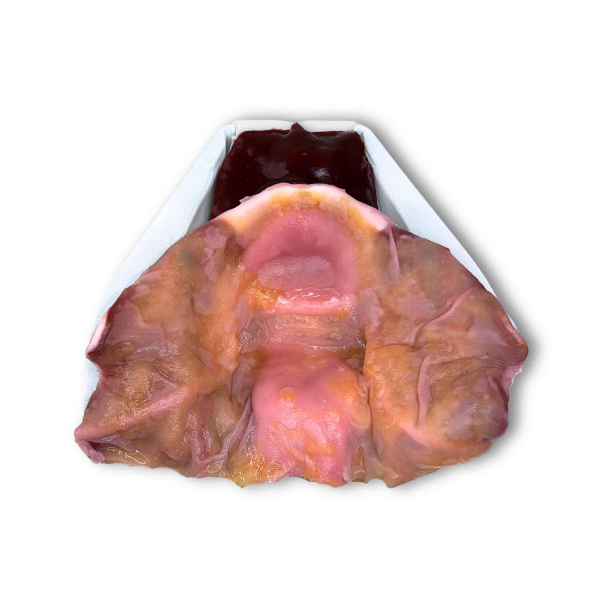 Prostate (Class V)